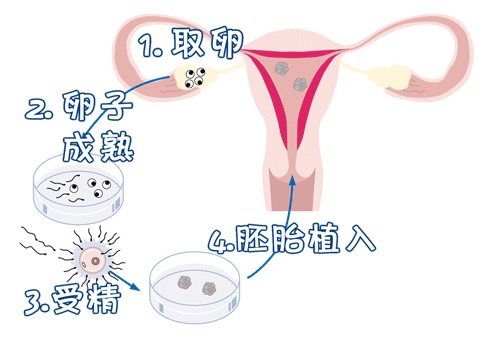 42岁高龄成功案例